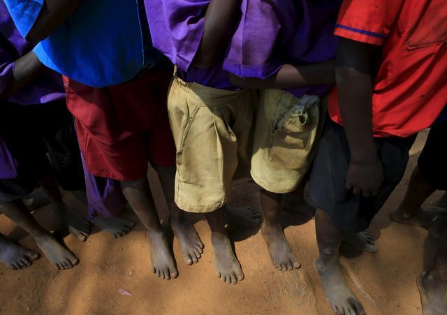 直擊恐怖的非洲沙蚤病,治療全過程曝光