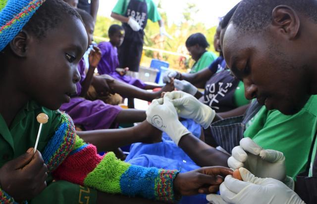 直擊恐怖的非洲沙蚤病,治療全過程曝光