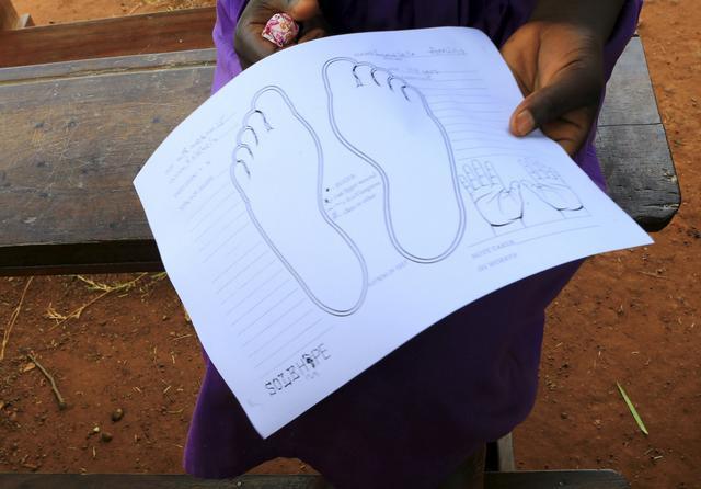 直擊恐怖的非洲沙蚤病,治療全過程曝光